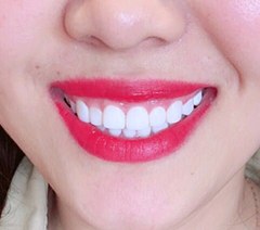 天津Le.S乐八·牙齿美白臻瓷美牙学校轮播4