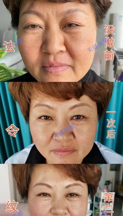郑州天健针灸美雕培训中心轮播5