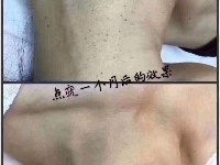美疣堂智慧美校学习资讯2