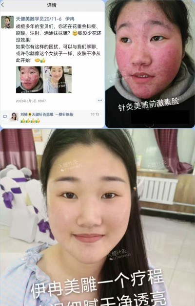 郑州天健针灸美雕培训中心轮播4